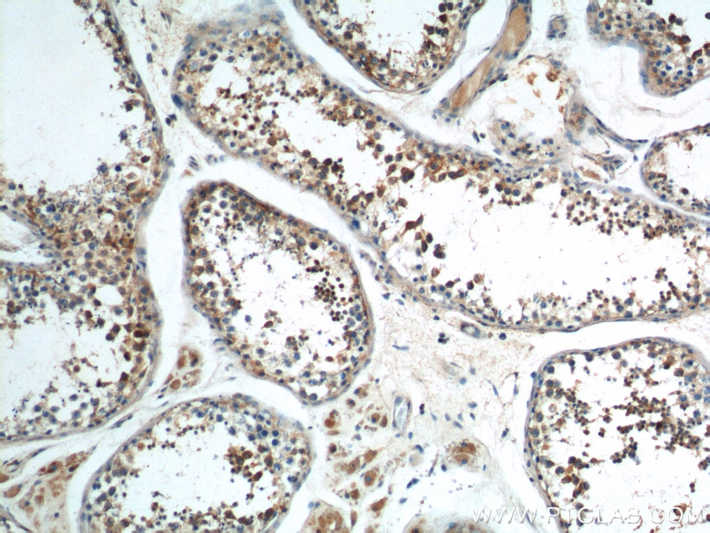 Immunohistochemistry (IHC) staining of human testis tissue using AKD1 Polyclonal antibody (23042-1-AP)