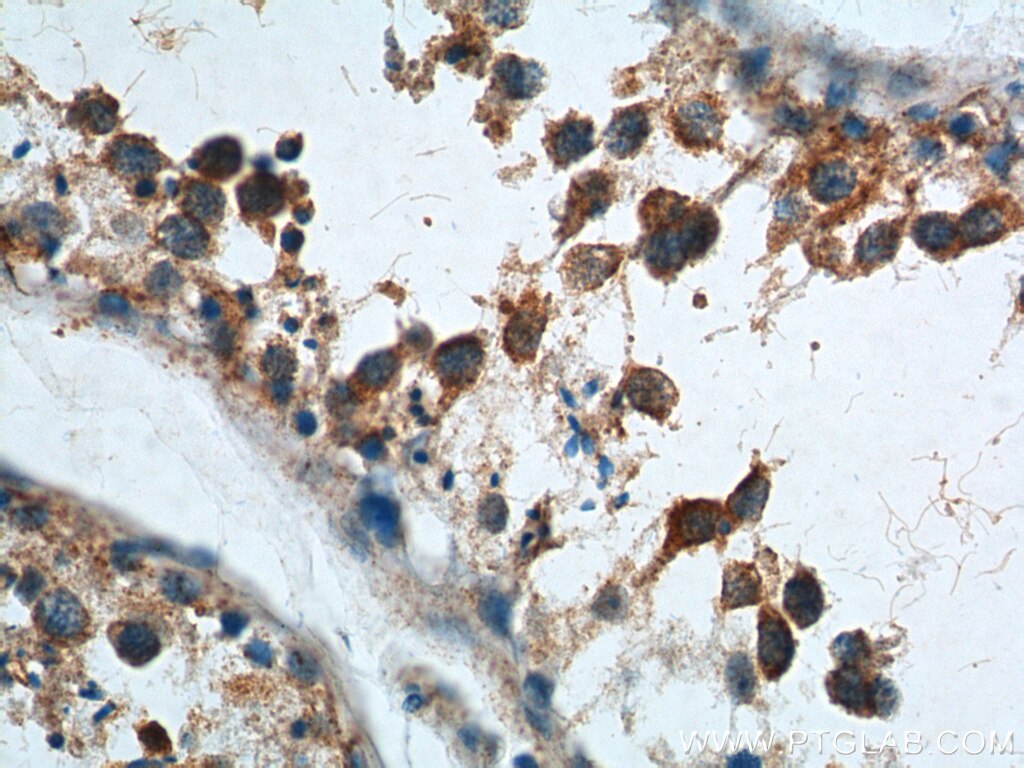 Immunohistochemistry (IHC) staining of human testis tissue using AKD1 Polyclonal antibody (23042-1-AP)