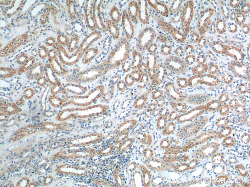 Immunohistochemistry (IHC) staining of human kidney tissue using AKD1 Polyclonal antibody (23042-1-AP)