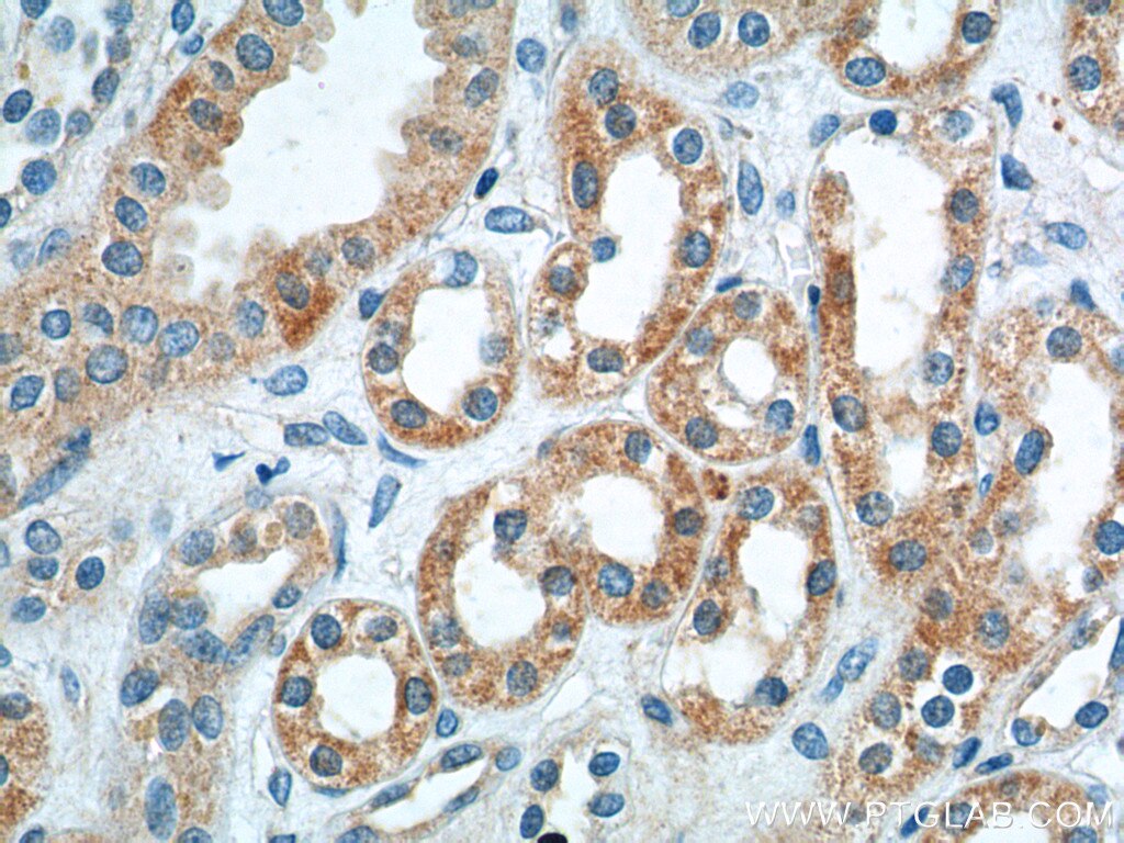 Immunohistochemistry (IHC) staining of human kidney tissue using AKD1 Polyclonal antibody (23042-1-AP)