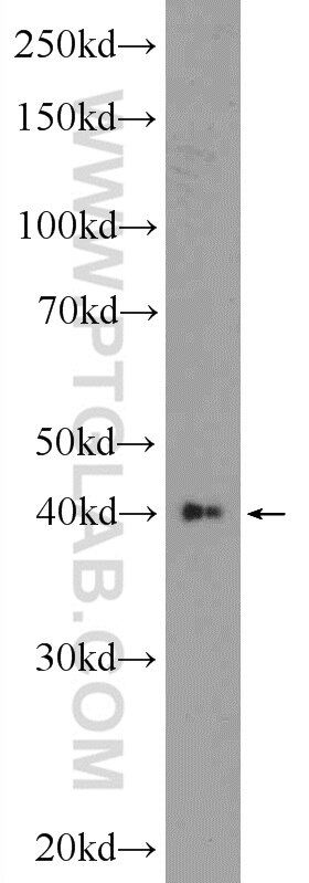 Western Blot (WB) analysis of HEK-293 cells using AKD1 Polyclonal antibody (23042-1-AP)