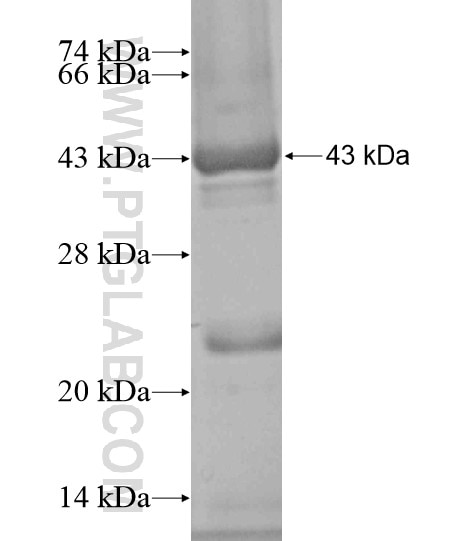 AKD1 fusion protein Ag19038 SDS-PAGE