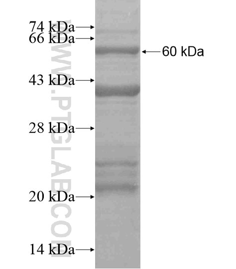 AKD1 fusion protein Ag19154 SDS-PAGE