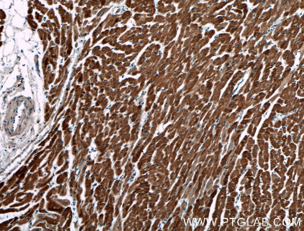 Immunohistochemistry (IHC) staining of human heart tissue using AKD2 Polyclonal antibody (27554-1-AP)