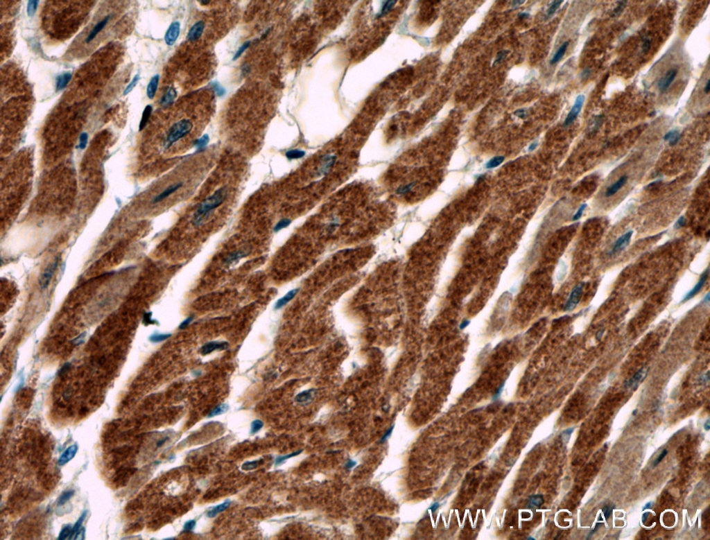 Immunohistochemistry (IHC) staining of human heart tissue using AKD2 Polyclonal antibody (27554-1-AP)