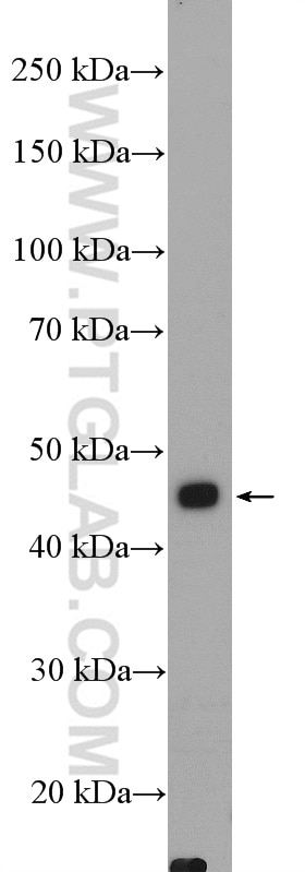 Western Blot (WB) analysis of SMMC-7721 cells using AKD2 Polyclonal antibody (27554-1-AP)