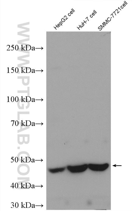 Western Blot (WB) analysis of various lysates using AKD2 Polyclonal antibody (27554-1-AP)