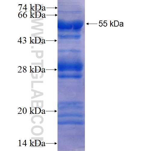 AKD2 fusion protein Ag25805 SDS-PAGE
