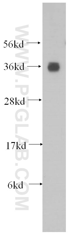 Western Blot (WB) analysis of HeLa cells using AKR1A1 Polyclonal antibody (15054-1-AP)