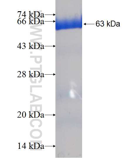AKR1A1 fusion protein Ag7037 SDS-PAGE
