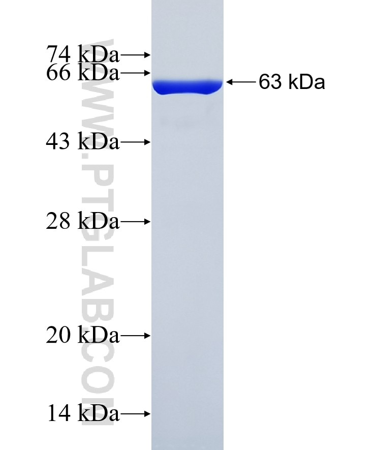 AKR1A1 fusion protein Ag7037 SDS-PAGE