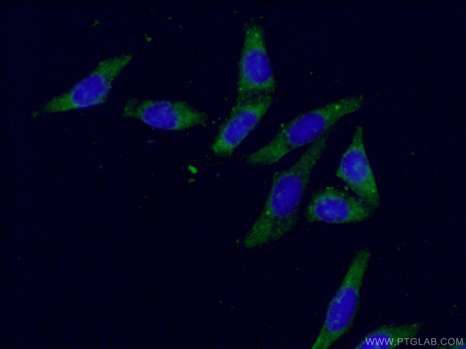 Immunofluorescence (IF) / fluorescent staining of HepG2 cells using AKR1B1 Polyclonal antibody (15439-1-AP)
