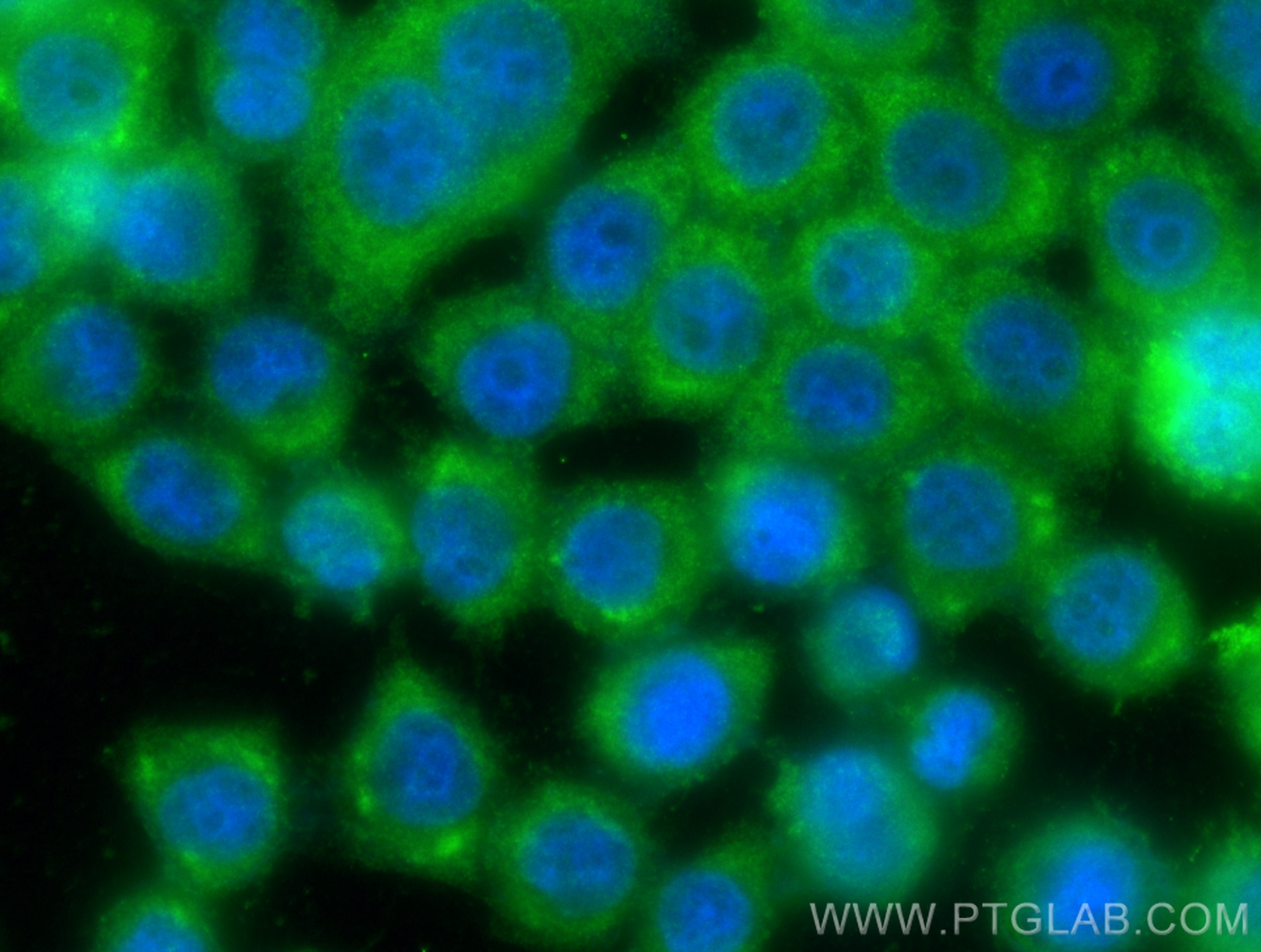 Immunofluorescence (IF) / fluorescent staining of BxPC-3 cells using AKR1B1 Polyclonal antibody (15439-1-AP)