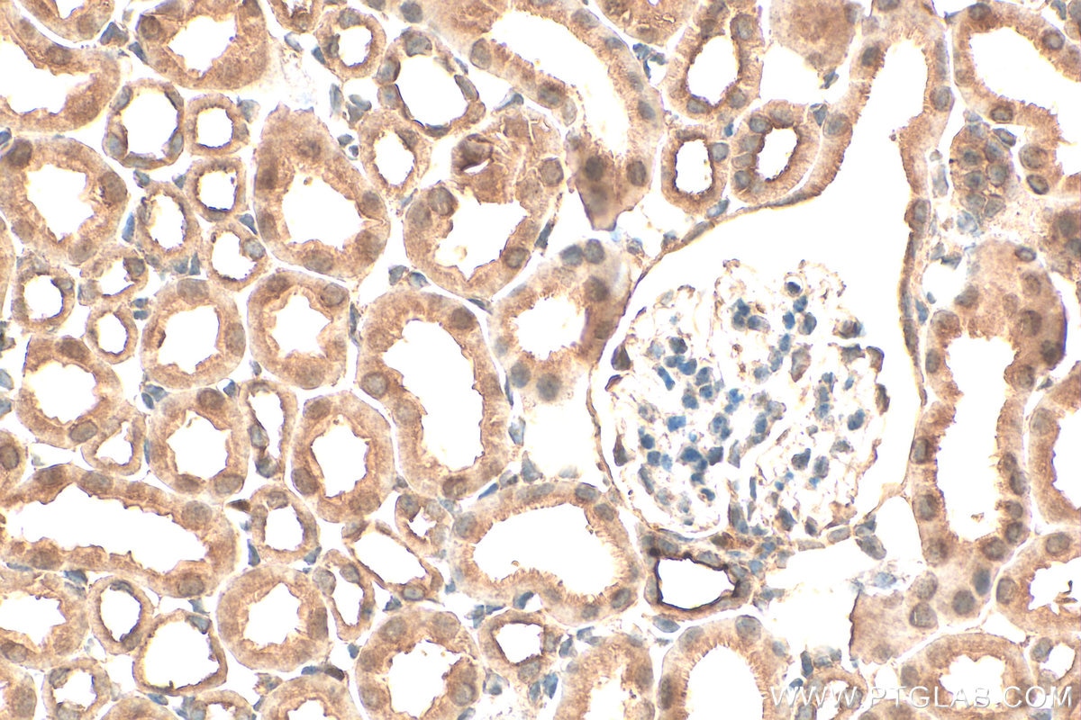 Immunohistochemistry (IHC) staining of mouse kidney tissue using AKR1B1 Polyclonal antibody (15439-1-AP)
