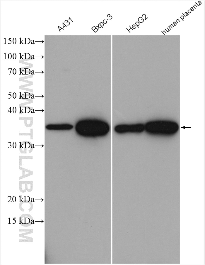Western Blot (WB) analysis of various lysates using AKR1B1 Polyclonal antibody (15439-1-AP)