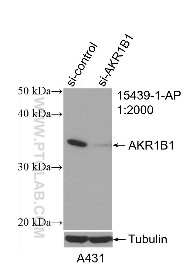 Western Blot (WB) analysis of A431 cells using AKR1B1 Polyclonal antibody (15439-1-AP)