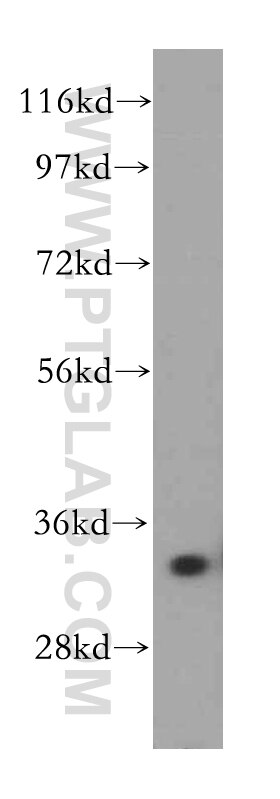 Western Blot (WB) analysis of human liver tissue using AKR1B1 Polyclonal antibody (15439-1-AP)