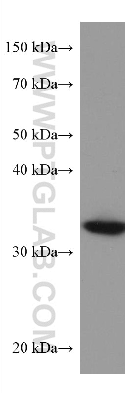 Western Blot (WB) analysis of HeLa cells using AKR1B1 Monoclonal antibody (67498-1-Ig)