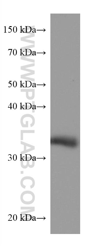 Western Blot (WB) analysis of 4T1 cells using AKR1B1 Monoclonal antibody (67498-1-Ig)