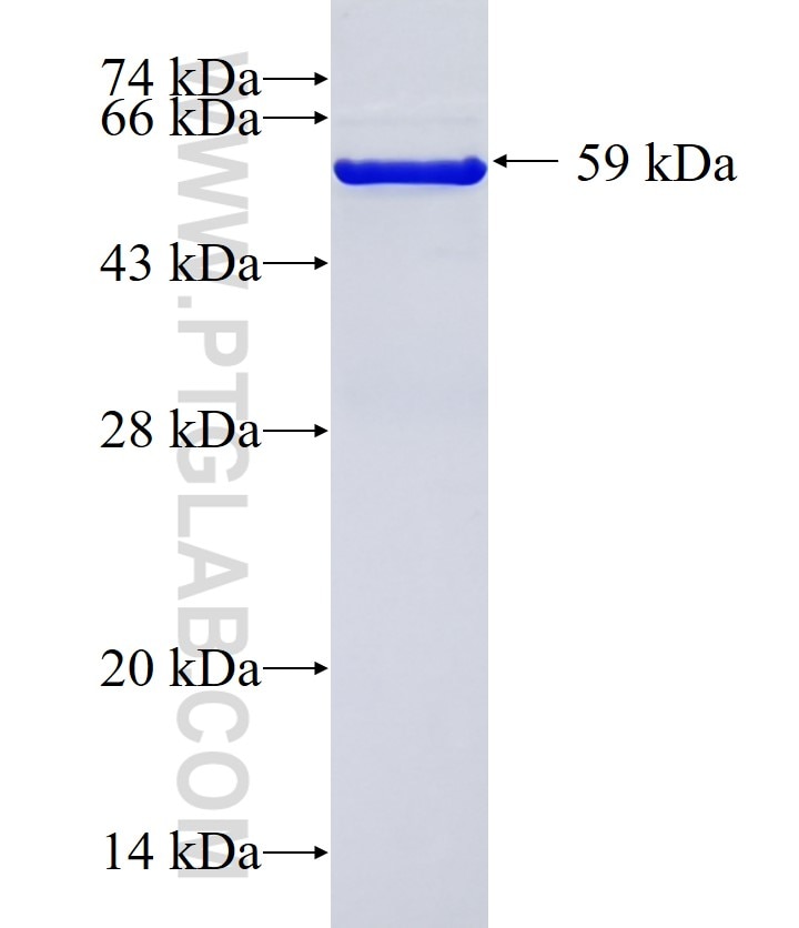 AKR1B1 fusion protein Ag7142 SDS-PAGE