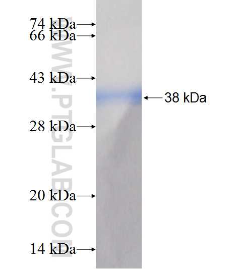 AKR1B1 fusion protein Ag7571 SDS-PAGE