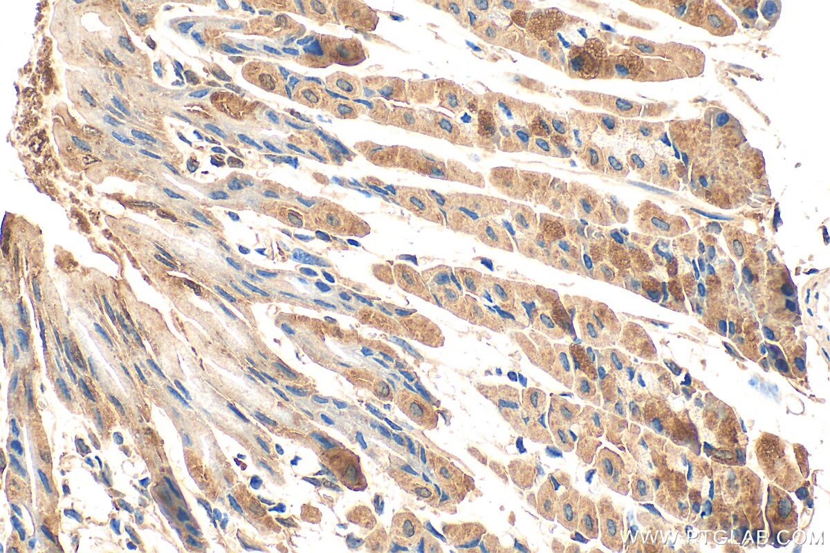 Immunohistochemistry (IHC) staining of mouse stomach tissue using AKR1B10 Polyclonal antibody (18252-1-AP)
