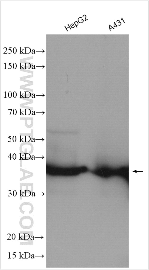 Western Blot (WB) analysis of various lysates using AKR1B10 Polyclonal antibody (18252-1-AP)