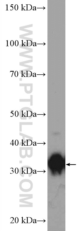 AKR1B10