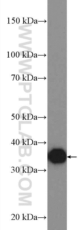 Western Blot (WB) analysis of mouse liver tissue using AKR1B10 Polyclonal antibody (18252-1-AP)