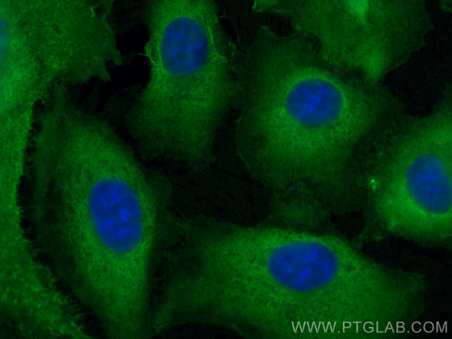 Immunofluorescence (IF) / fluorescent staining of A549 cells using AKR1B10 Monoclonal antibody (68327-1-Ig)