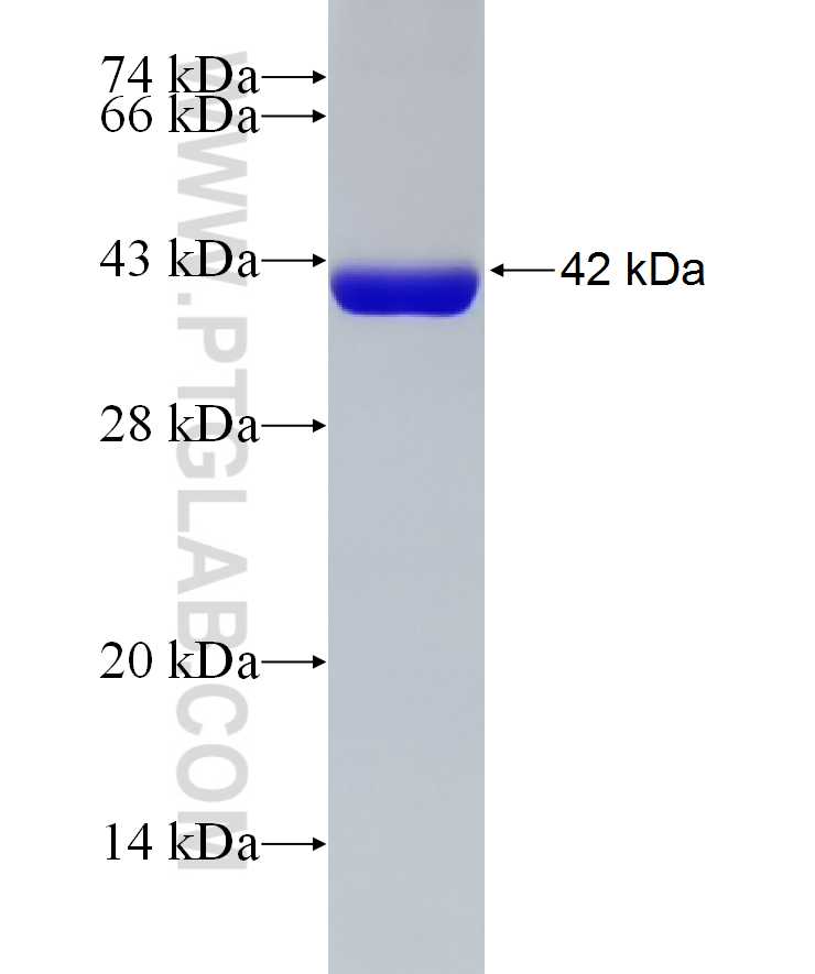 AKR1B10 fusion protein Ag24406 SDS-PAGE