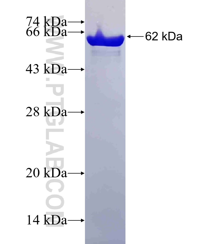 AKR1B10 fusion protein Ag13042 SDS-PAGE