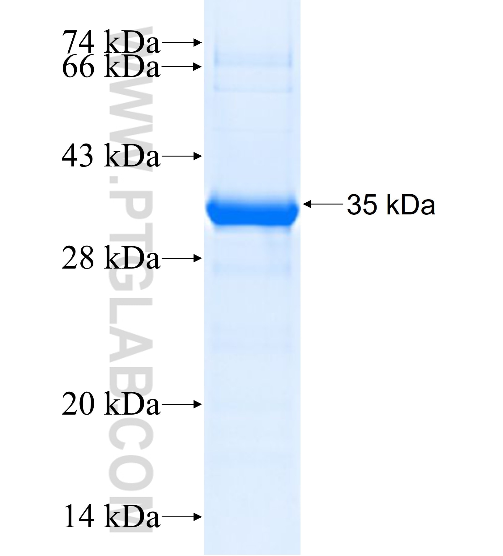AKR1C1 fusion protein Ag37626 SDS-PAGE AKR1C1 fusion protein Ag37626 SDS-PAGE