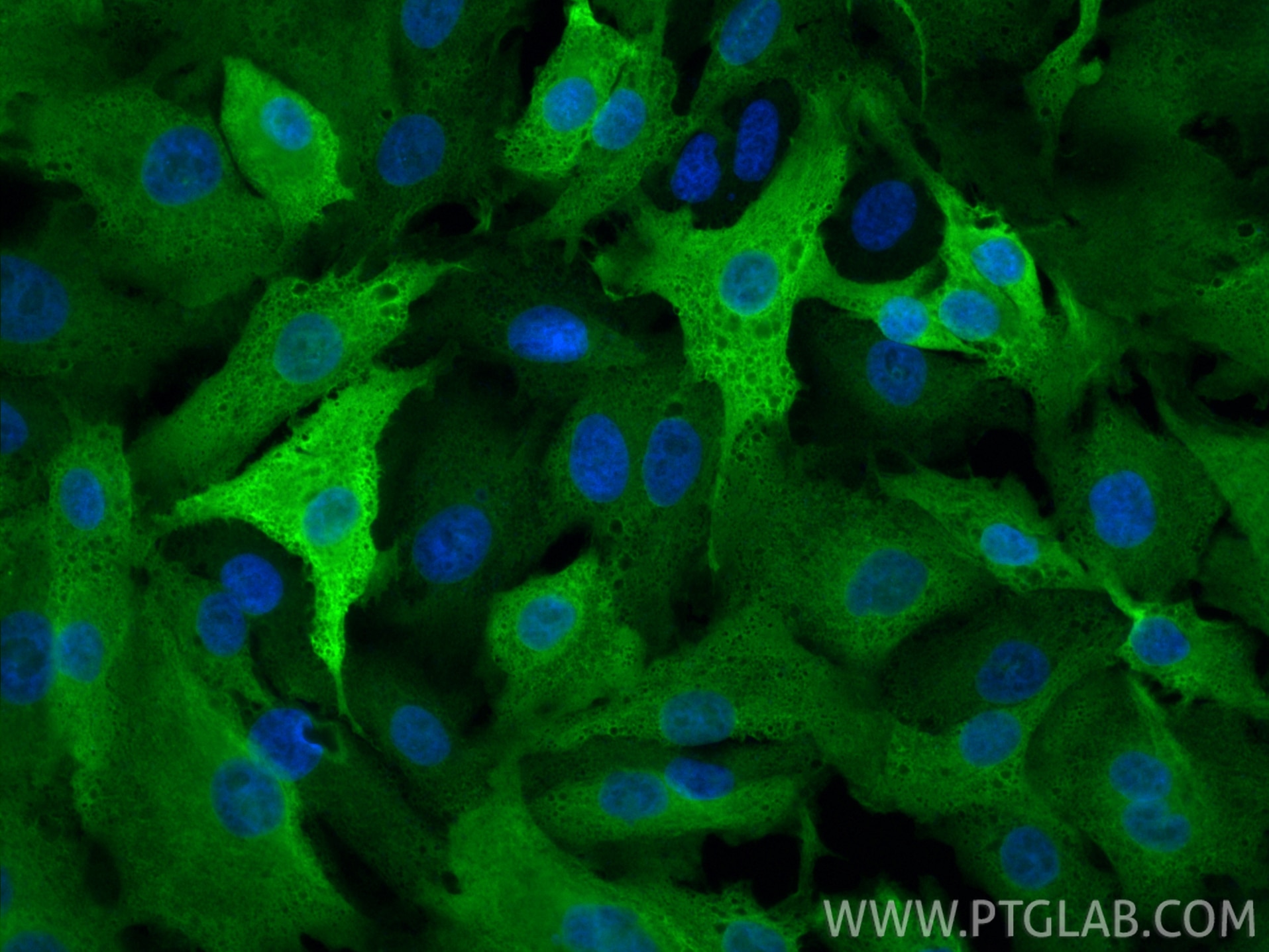 Immunofluorescence (IF) / fluorescent staining of A549 cells using AKR1C3 Polyclonal antibody (11194-1-AP)