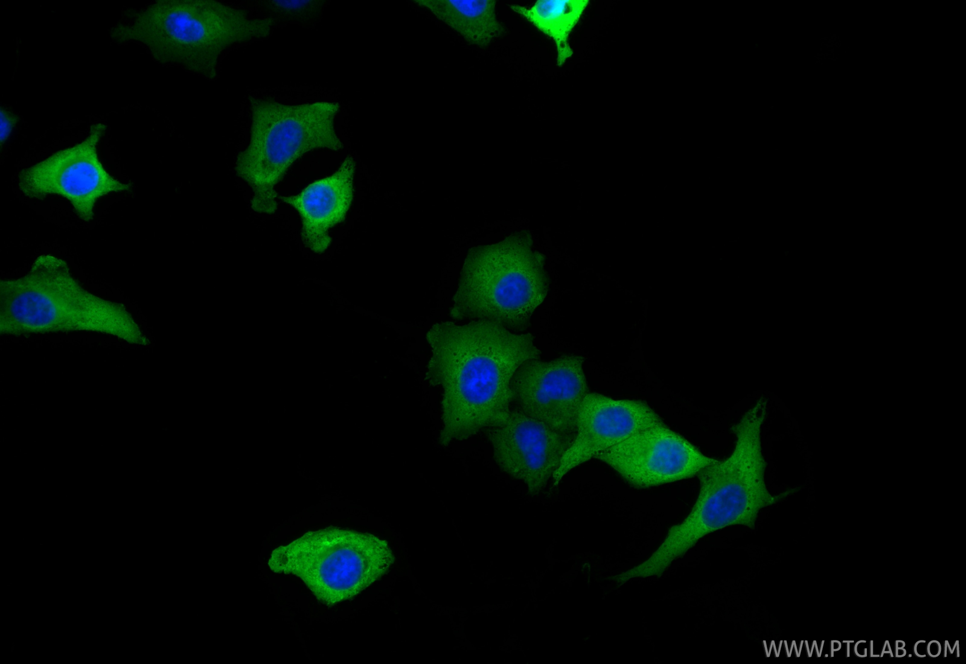 Immunofluorescence (IF) / fluorescent staining of A549 cells using AKR1C3 Polyclonal antibody (11194-1-AP)