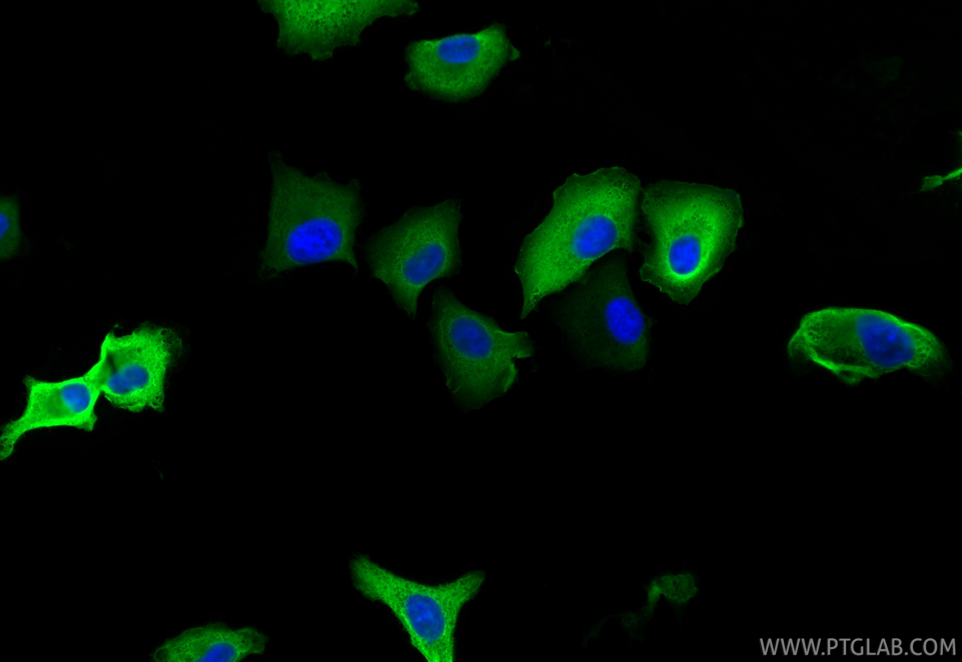 Immunofluorescence (IF) / fluorescent staining of A549 cells using Multi-rAb® AKR1C3 Multi-Recombinant antibody (RMX00069)