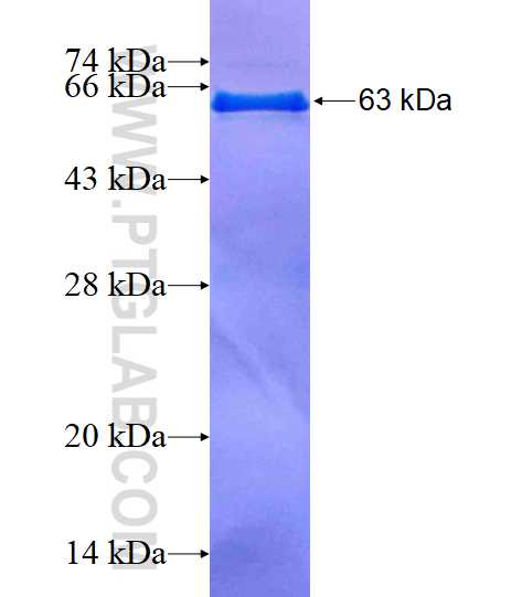 AKR1C3 fusion protein Ag1674 SDS-PAGE
