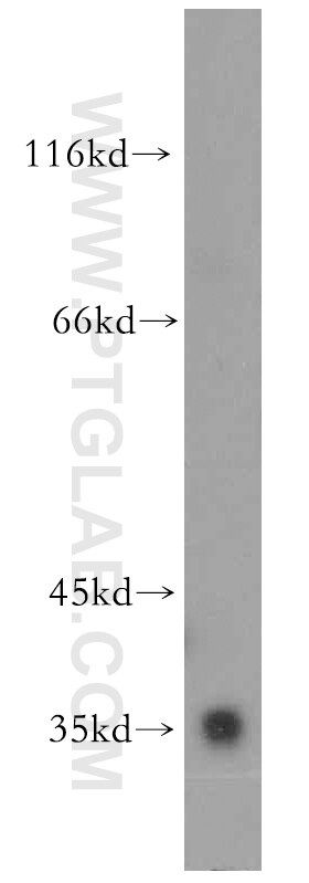 Western Blot (WB) analysis of mouse liver tissue using AKR1C4 Polyclonal antibody (18852-1-AP)