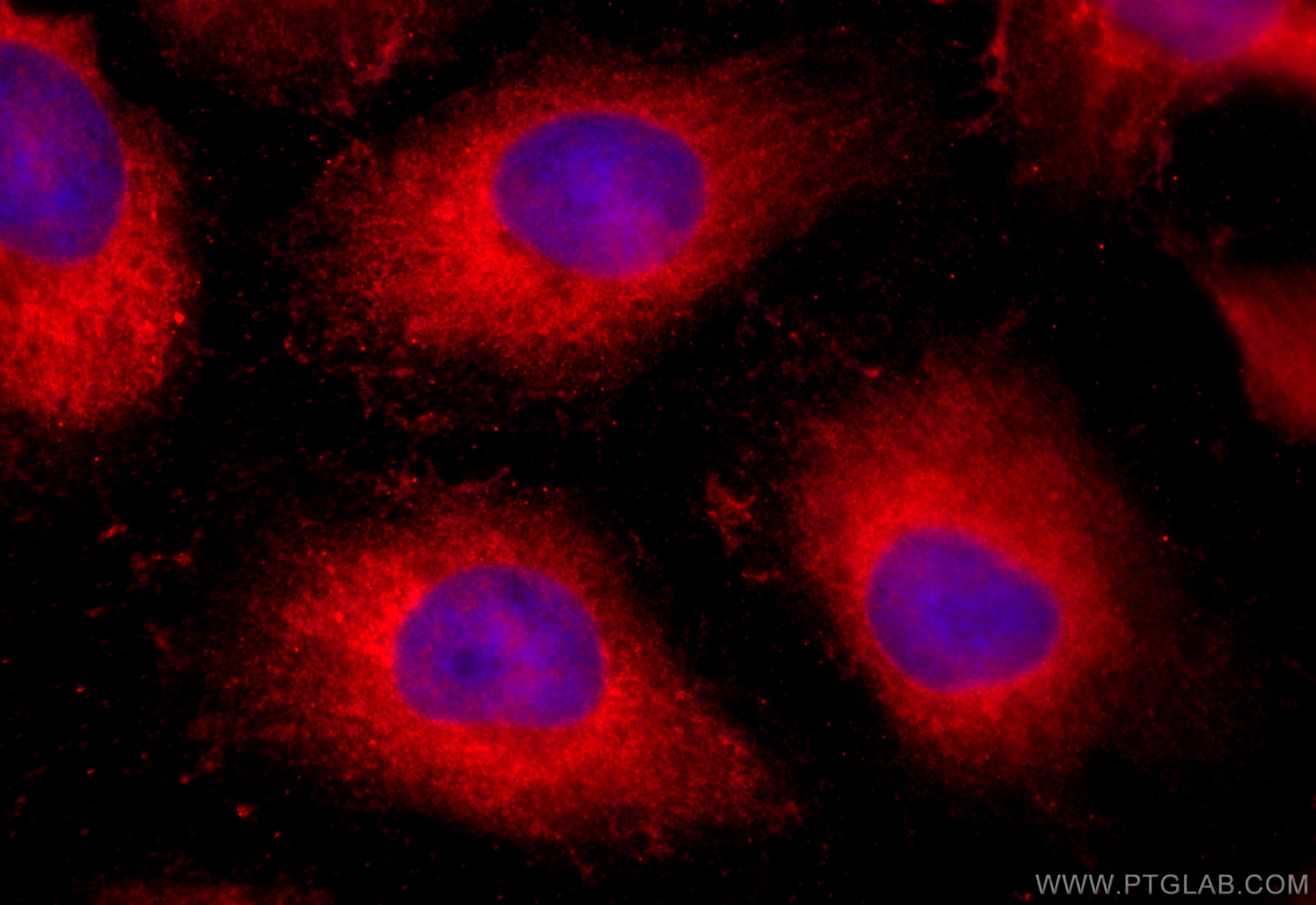 Immunofluorescence (IF) / fluorescent staining of HeLa cells using AKR1CL2 Polyclonal antibody (20525-1-AP)