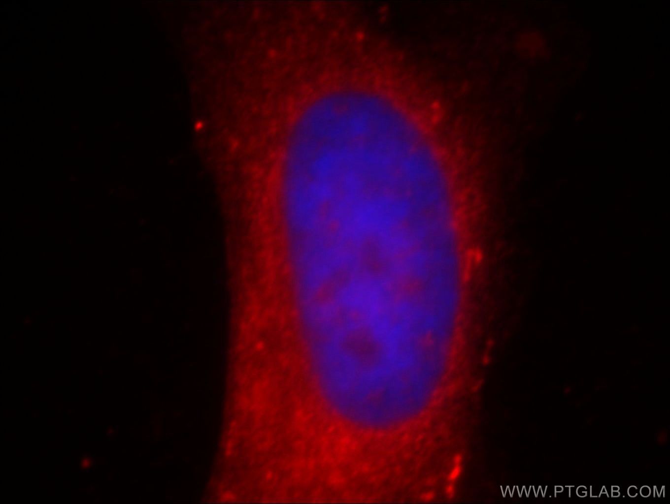 Immunofluorescence (IF) / fluorescent staining of HeLa cells using AKR1CL2 Polyclonal antibody (20525-1-AP)