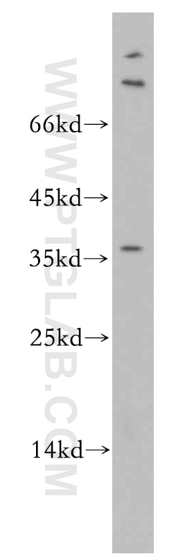 Western Blot (WB) analysis of HT-1080 cells using AKR1CL2 Polyclonal antibody (20525-1-AP)