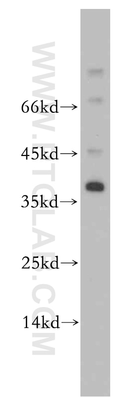 WB analysis of mouse testis using 20525-1-AP