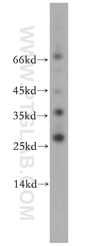 Western Blot (WB) analysis of RAW264.7 using AKR1CL2 Polyclonal antibody (20525-1-AP)