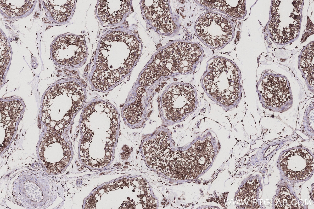 Immunohistochemistry (IHC) staining of human testis tissue using AKR7A2 Polyclonal antibody (10730-1-AP)