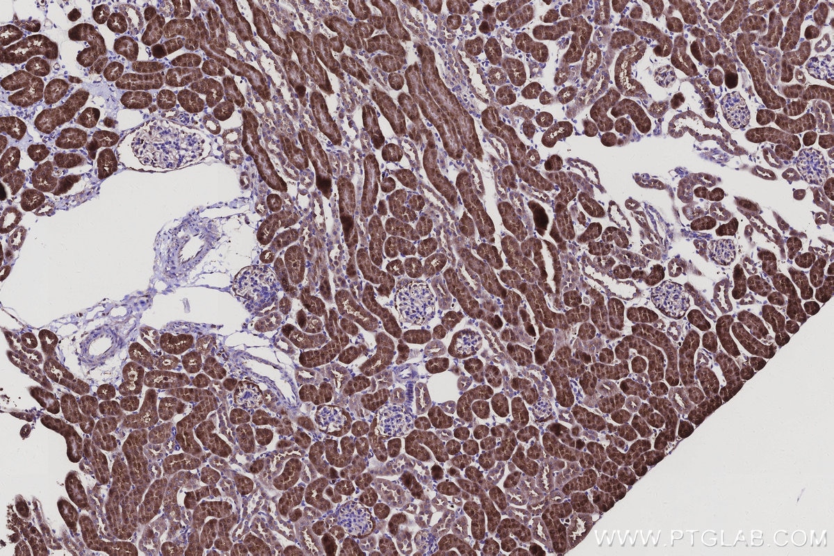 Immunohistochemistry (IHC) staining of mouse kidney tissue using AKR7A2 Polyclonal antibody (10730-1-AP)