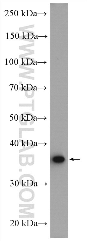 Western Blot (WB) analysis of A431 cells using AKR7A2 Polyclonal antibody (10730-1-AP)