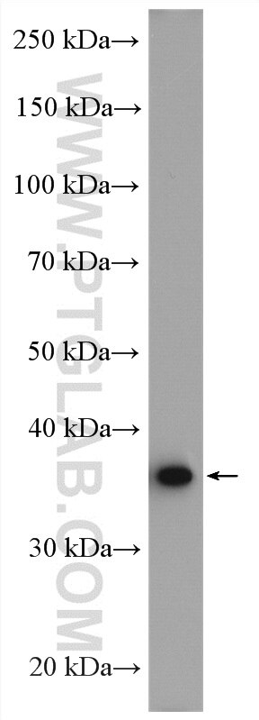 WB analysis of A431 using 10730-1-AP