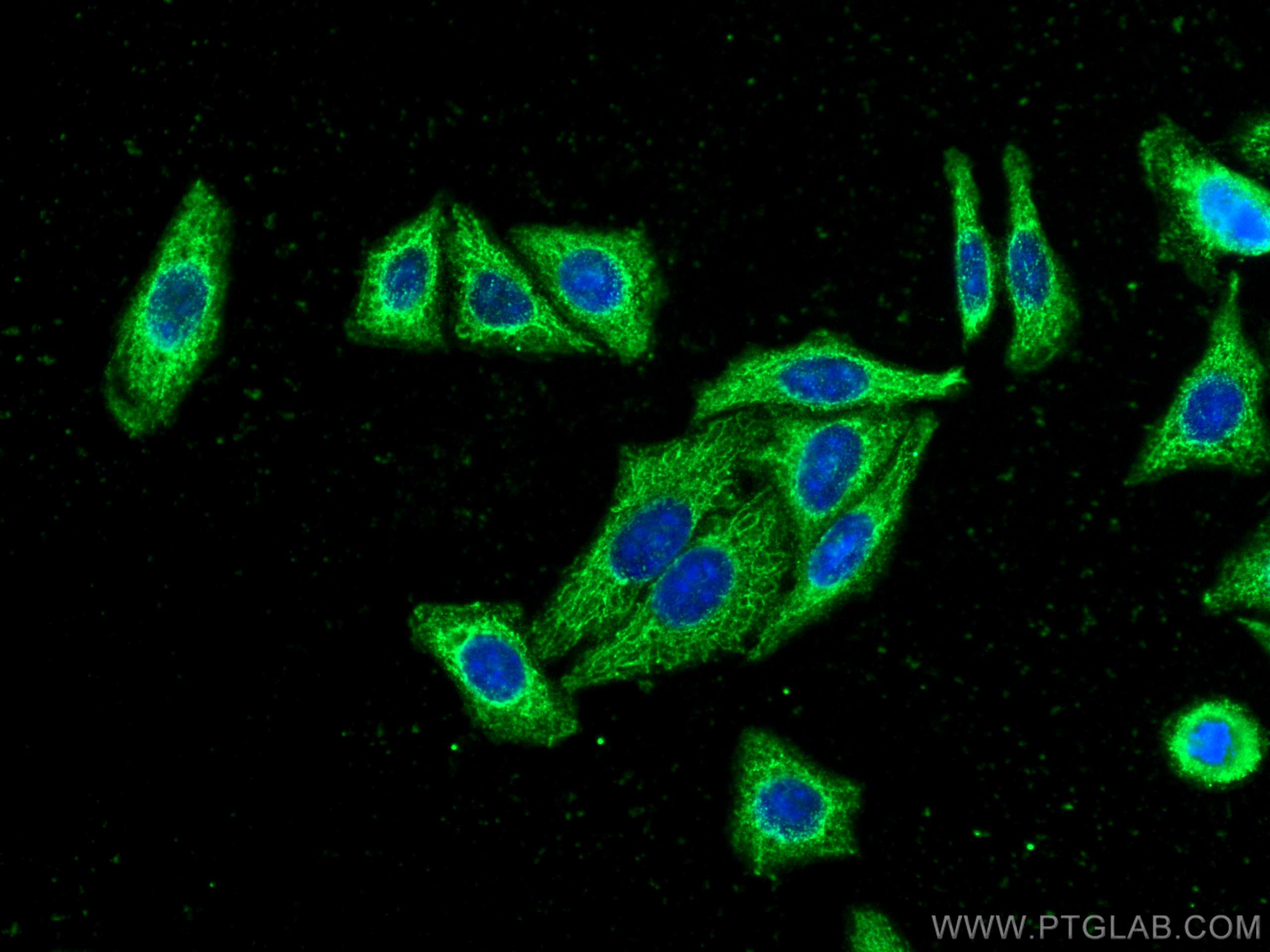 Immunofluorescence (IF) / fluorescent staining of HepG2 cells using AKR7A2 Monoclonal antibody (66677-1-Ig)