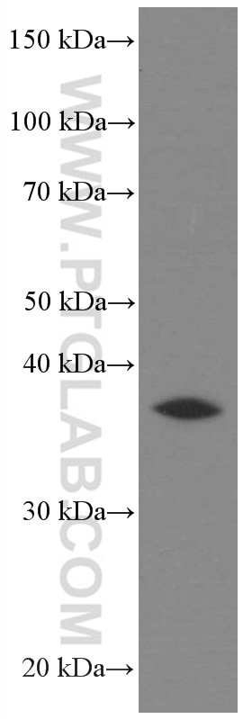 WB analysis of HEK-293 using 66677-1-Ig