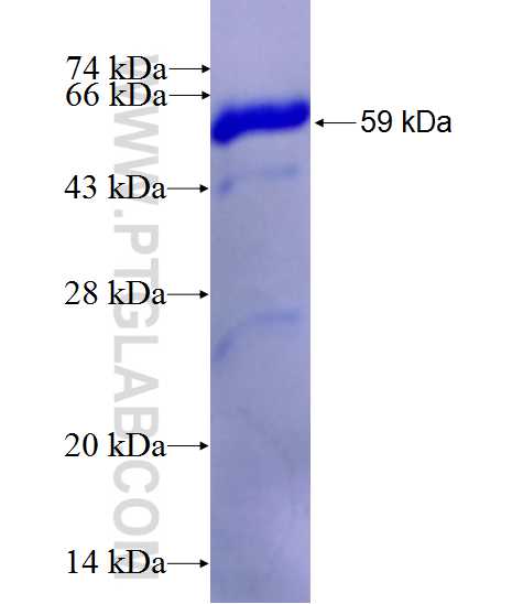 AKR7A2 fusion protein Ag1049 SDS-PAGE